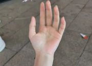“穷人的黄金”，爆了！商家：非常缺货