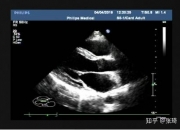 开立医疗获得发明专利授权：“一种标准切面图像替换方法、装置及超声设备和存储介质”