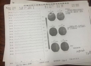 理邦仪器获得发明专利授权：“一种脑电阻抗测量系统及脑电阻抗的测量方法”