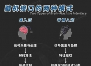 超百通道全侵入式脑机接口进入临床试验