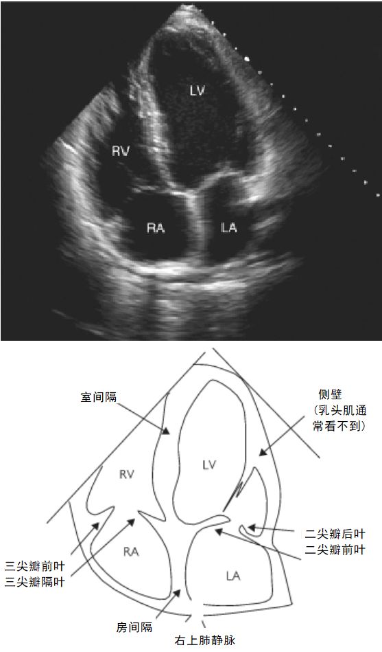 开立医疗获得发明专利授权：“一种标准切面图像替换方法、装置及超声设备和存储介质”