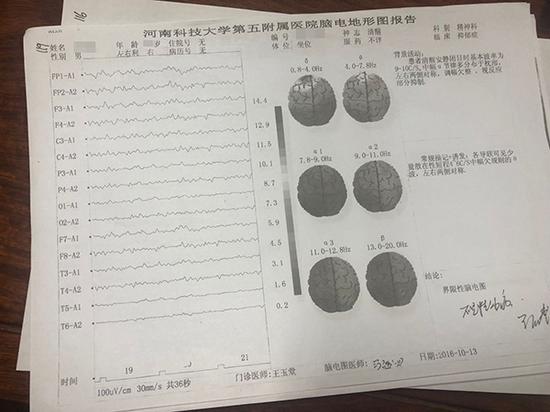 理邦仪器获得发明专利授权：“一种脑电阻抗测量系统及脑电阻抗的测量方法”