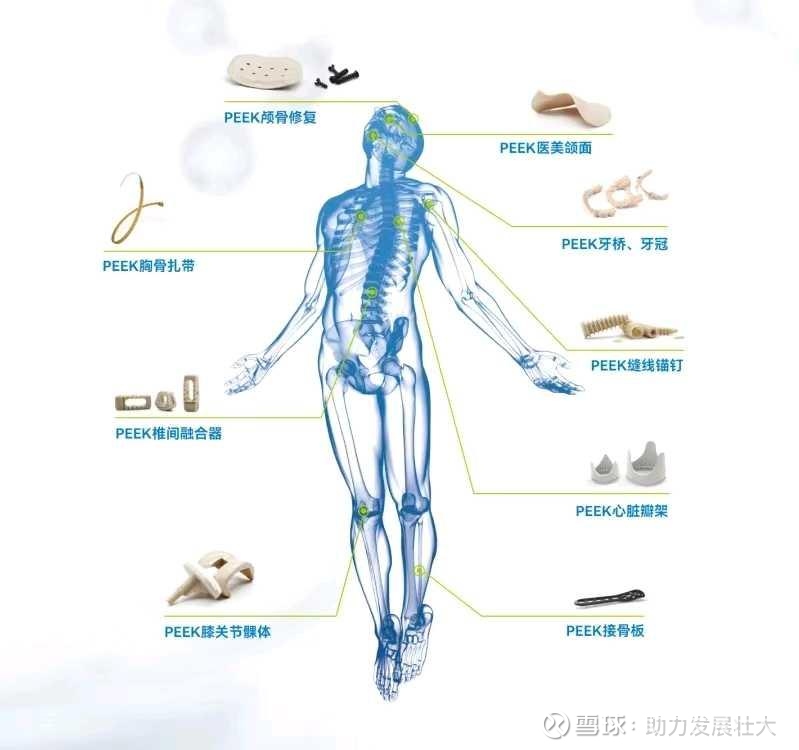 芬兰开发出能模仿天然骨骼的3D打印植入材料